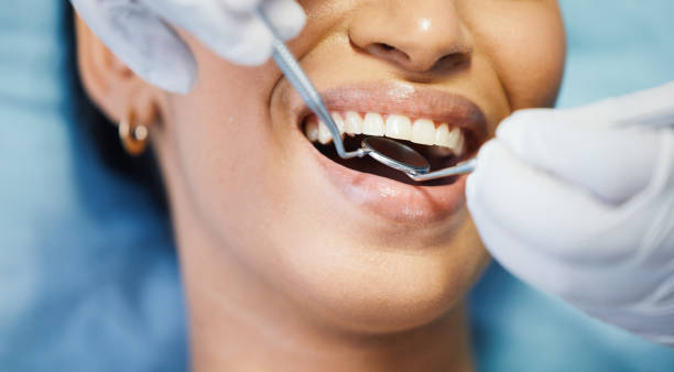 Urgent Tooth Repair in ID